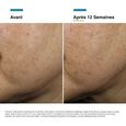 A.G.E. Interrupter Skinceuticals