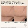 Age Perfect L'Or&eacute;al Paris