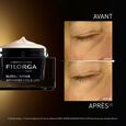 Global-Repair Eyes & Lips Filorga