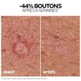 Effaclar Duo+M La Roche-Posay