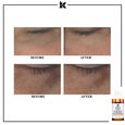 Powerful-Strength Line-Reducing & Dark Circle-Diminishing Vitamin C Kiehl's