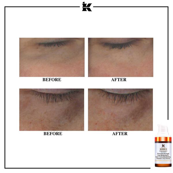 Powerful-Strength Line-Reducing & Dark Circle-Diminishing Vitamin C Kiehl s