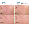 Advanced RGN-6 Skinceuticals