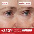 Liftactiv Vichy