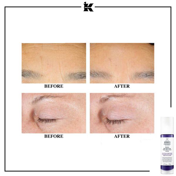 Retinol Skin-Renewing Daily Micro-Dose Serum Kiehl s