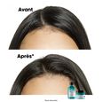 Serie Expert Scalp Advanced l'oréal professionnel