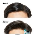 Serie Expert Scalp Advanced l'oréal professionnel