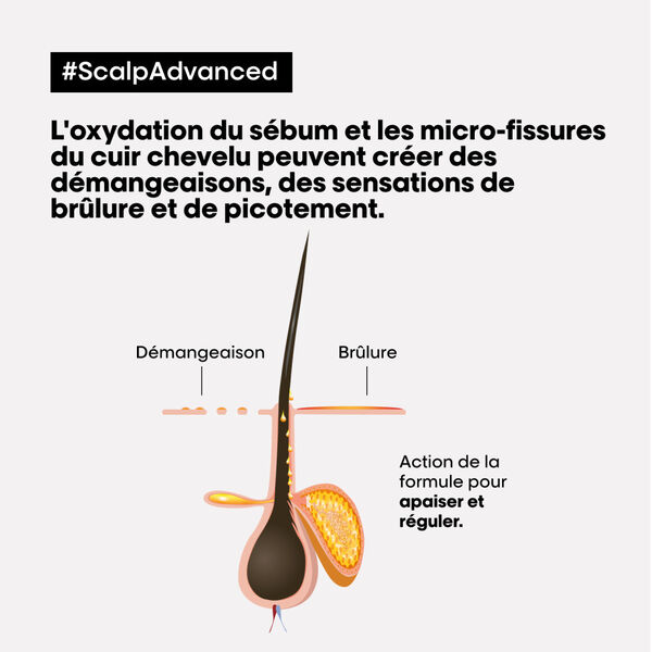 Scalp Advanced l'oréal professionnel